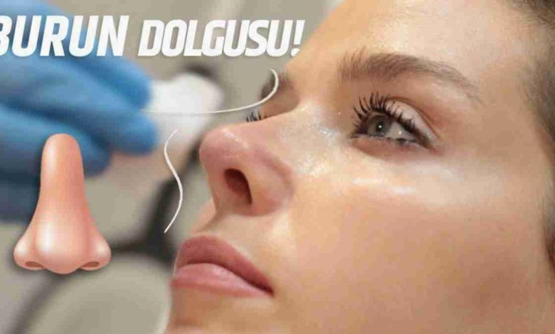 Burun Dolgusu Yaptıranlar Yorumları
