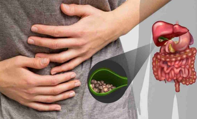 Safra Kesesi Ameliyatı Olanların Yorumları