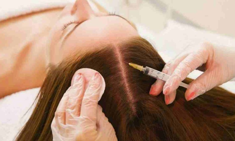 Saç Mezoterapisi Yaptıranların Yorumları