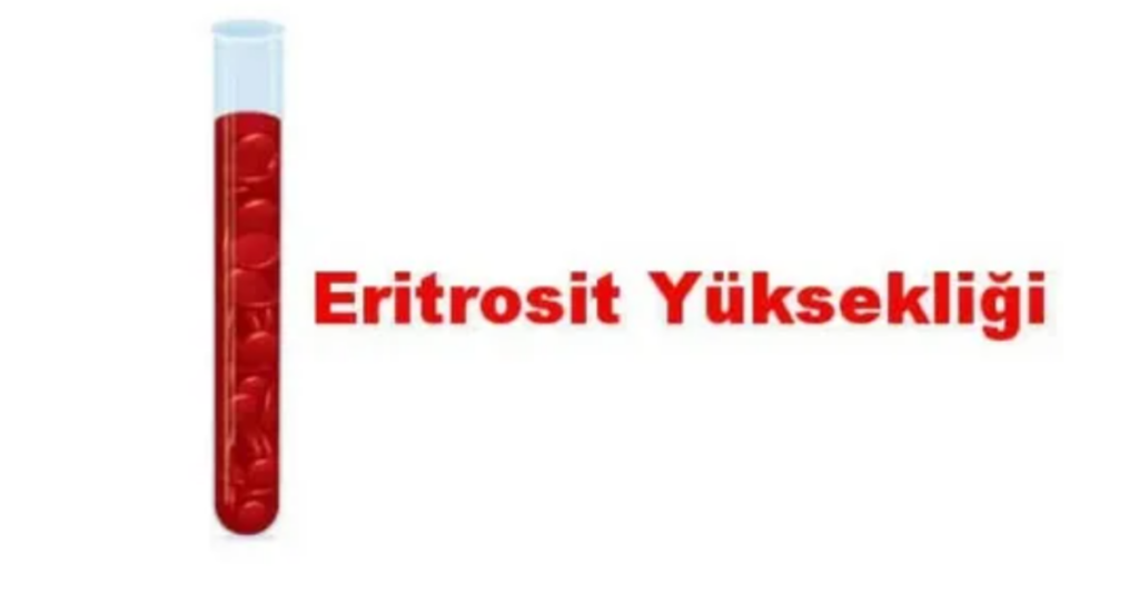 İdrarda Eritrosit Yüksekliği Yorumları
