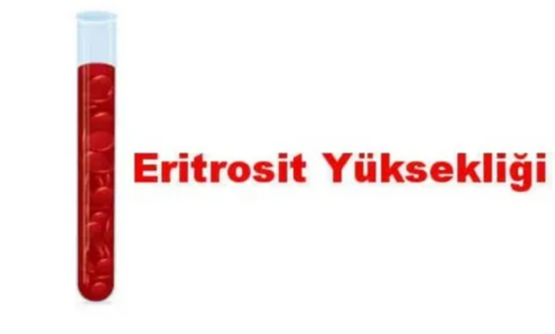 İdrarda Eritrosit Yüksekliği Yorumları