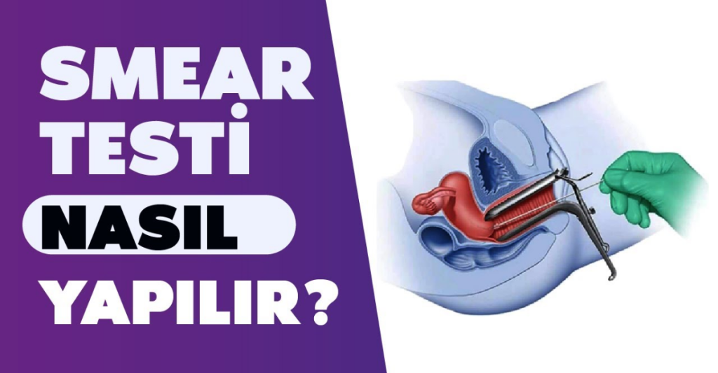 Smear Testi Yaptıranların Yorumları