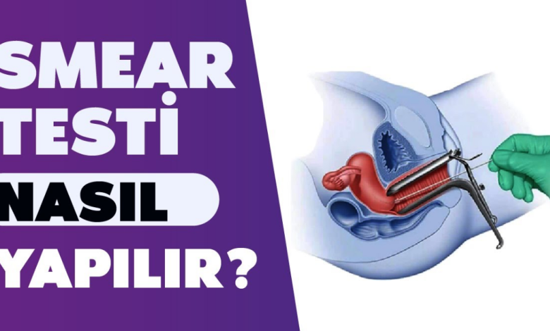 Smear Testi Yaptıranların Yorumları